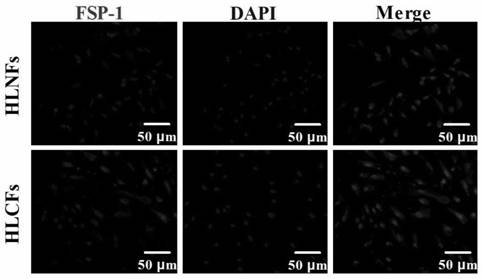 Establishment method of novel hepatic fibroblast strain