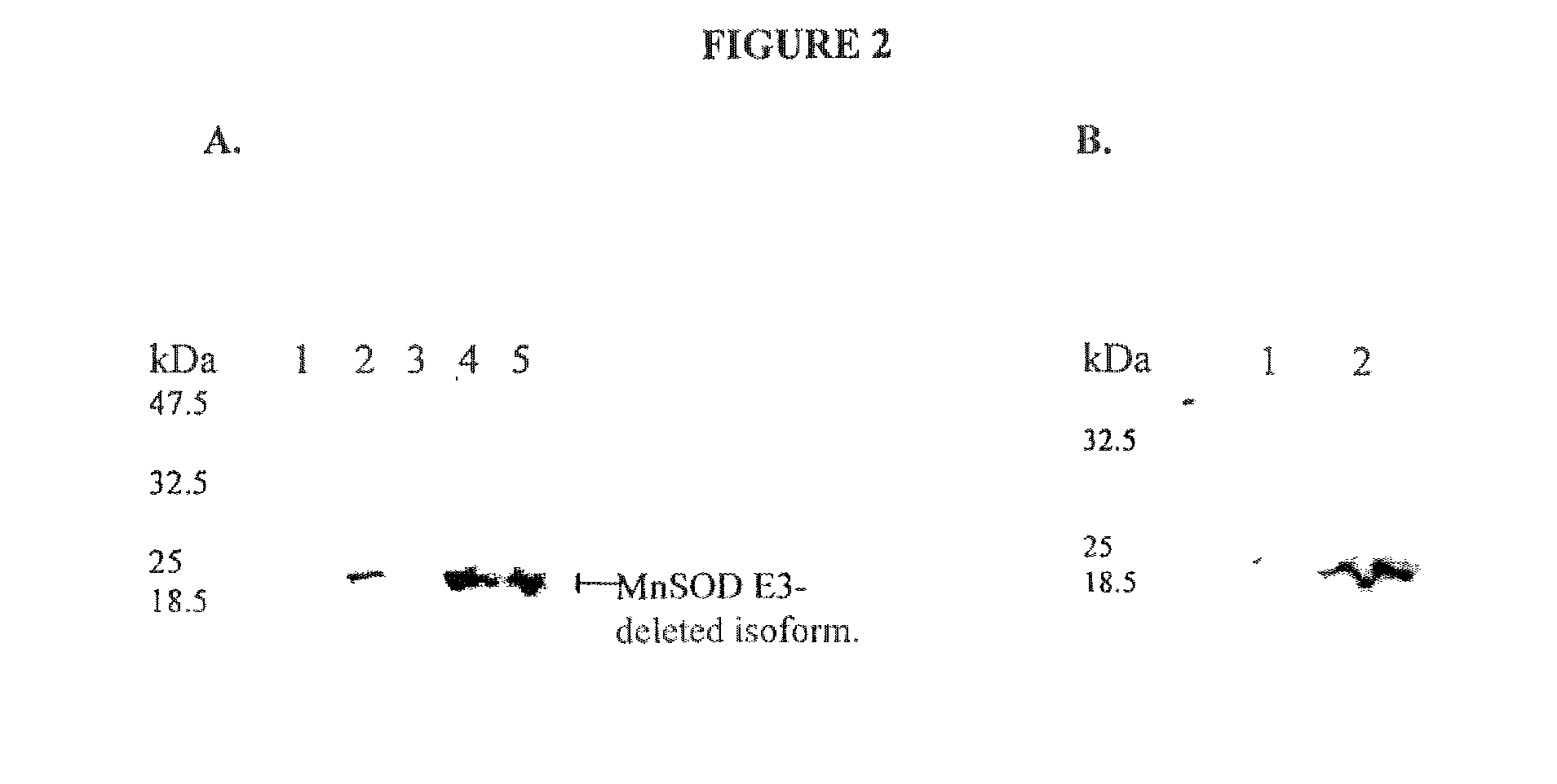 Compositions and Methods for Inhibiting an Isoform of Human Manganese Superoxide Dismutase