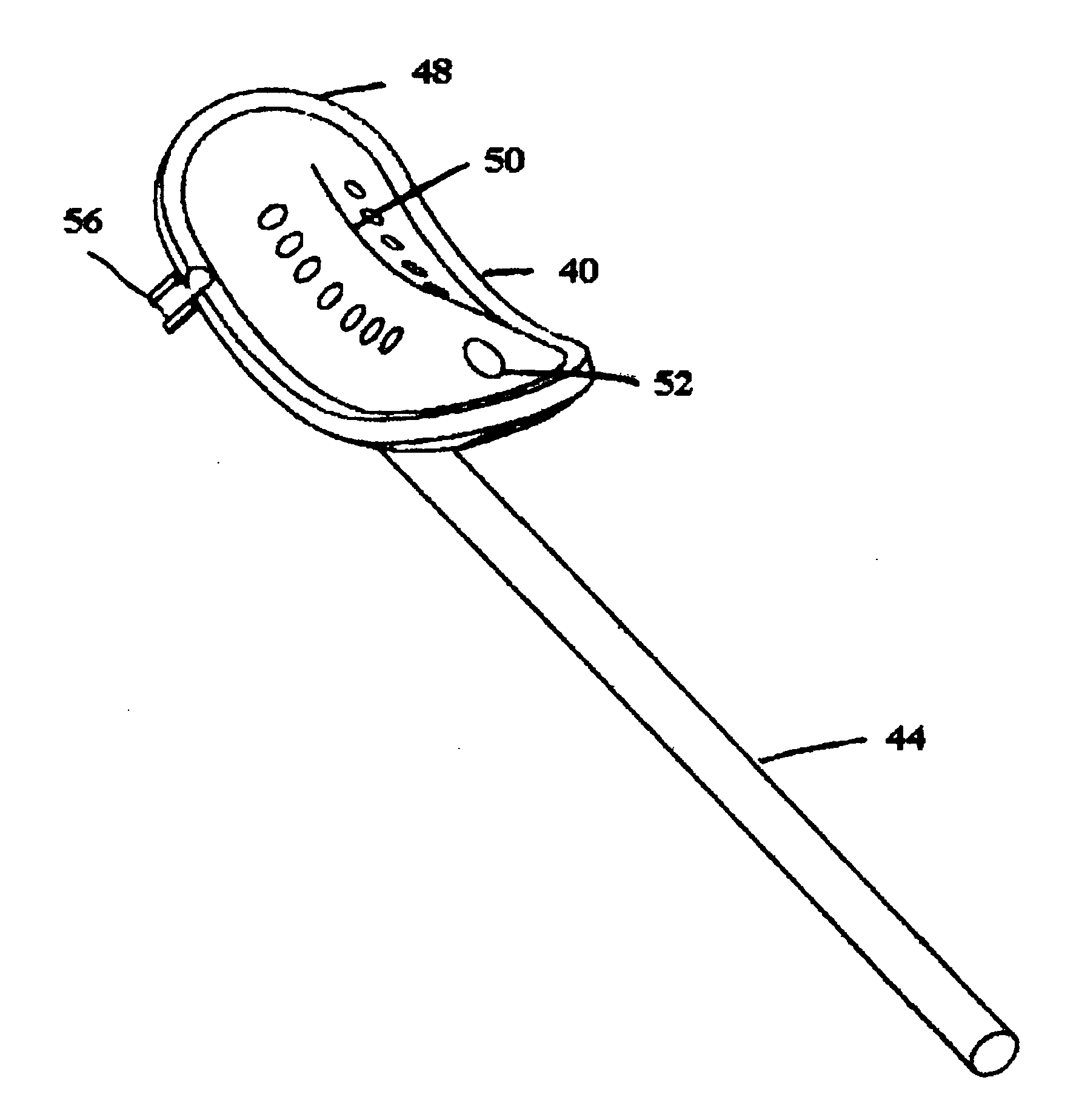 Instruments and method for arthroscopic arthroplasty of the knee