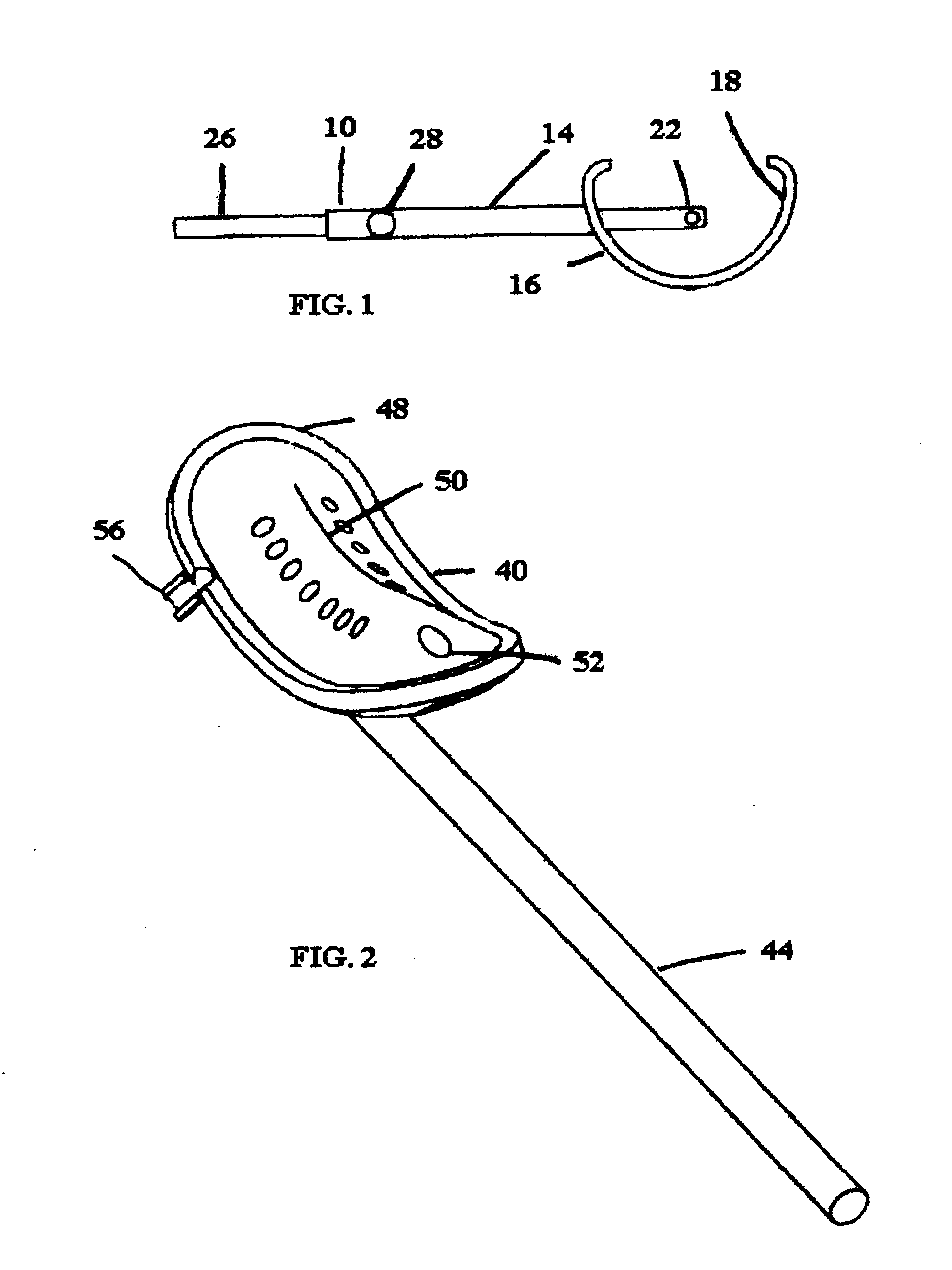 Instruments and method for arthroscopic arthroplasty of the knee