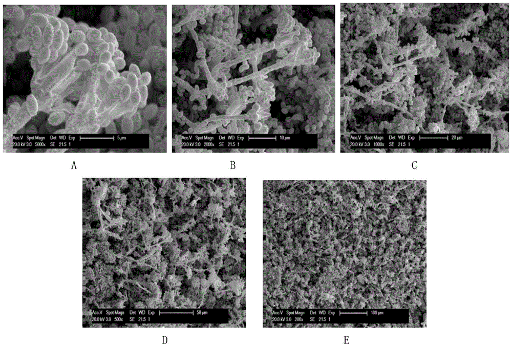 Endophytic fungus strain of Huperz serrata and its application