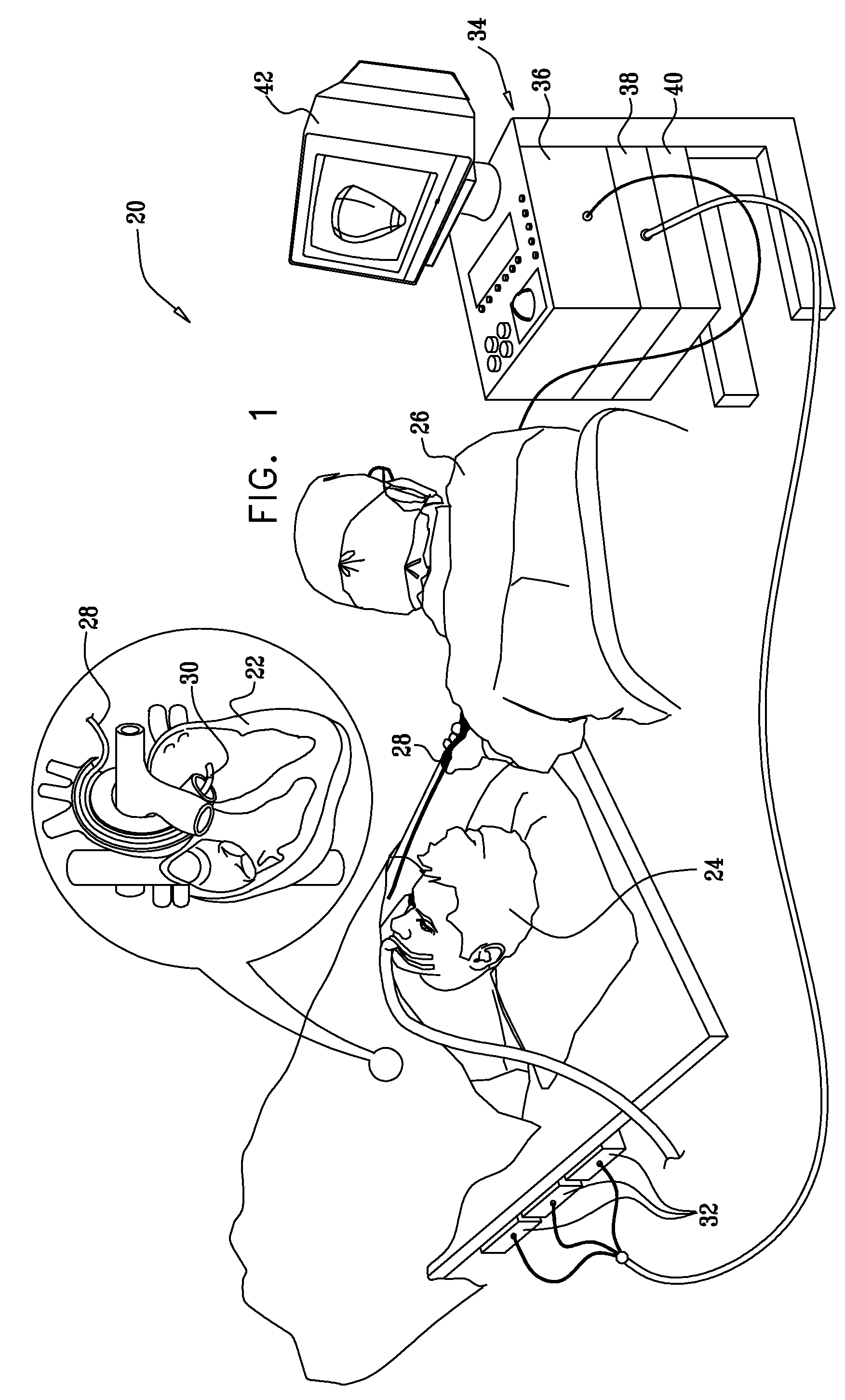 Catheter display showing tip angle and pressure