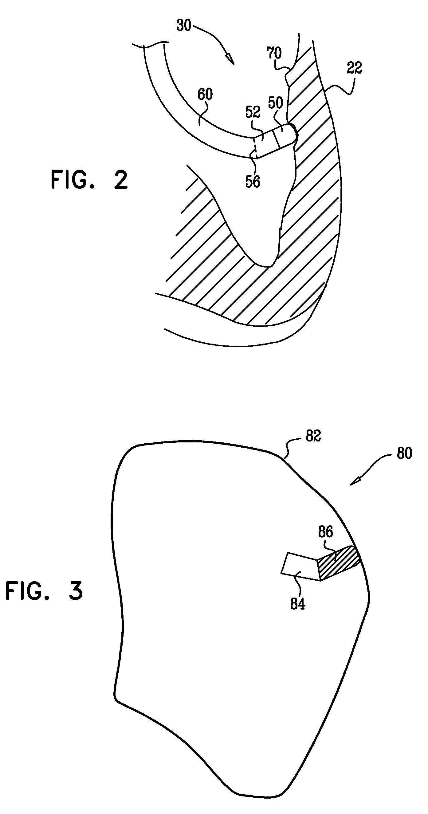 Catheter display showing tip angle and pressure