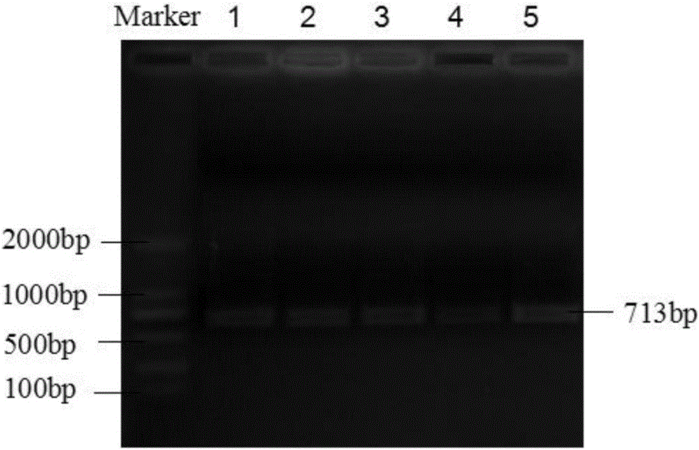 Primer and method for detecting HLA-DQ gene rs9275319 site polymorphism