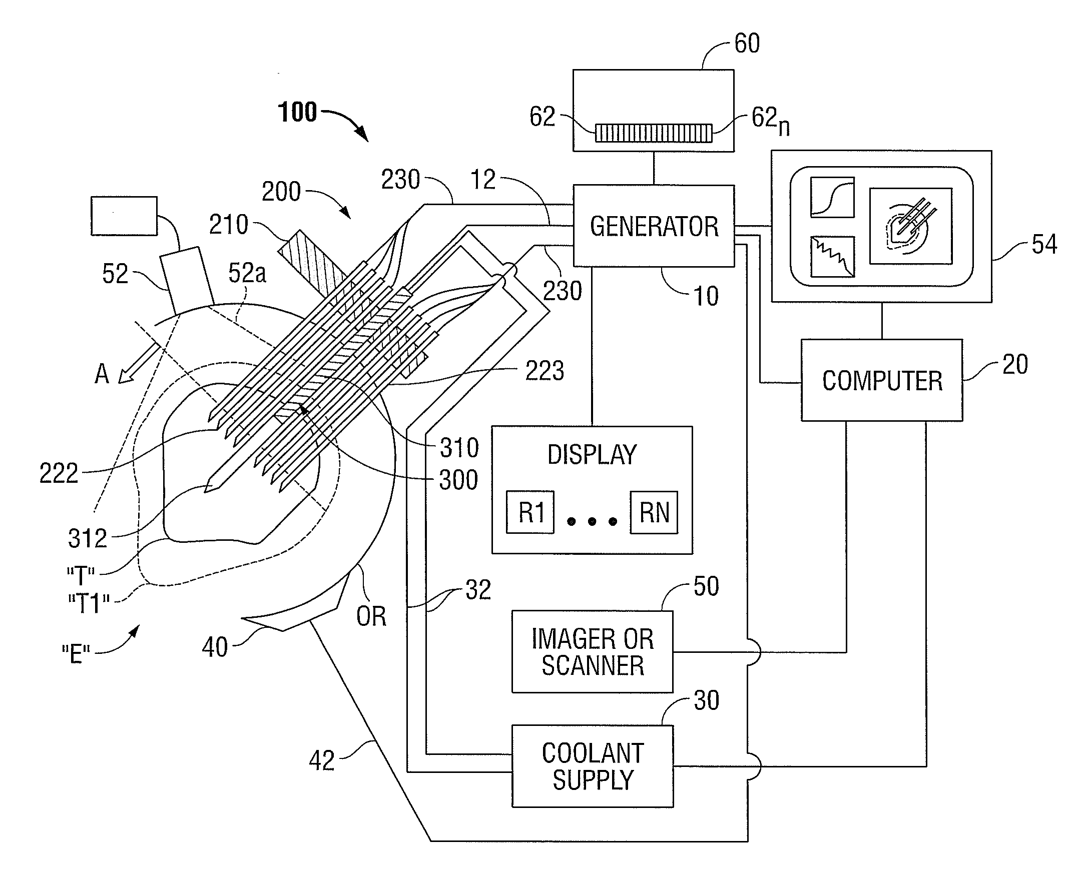 Temperature Based Ablation Completeness Algorithm