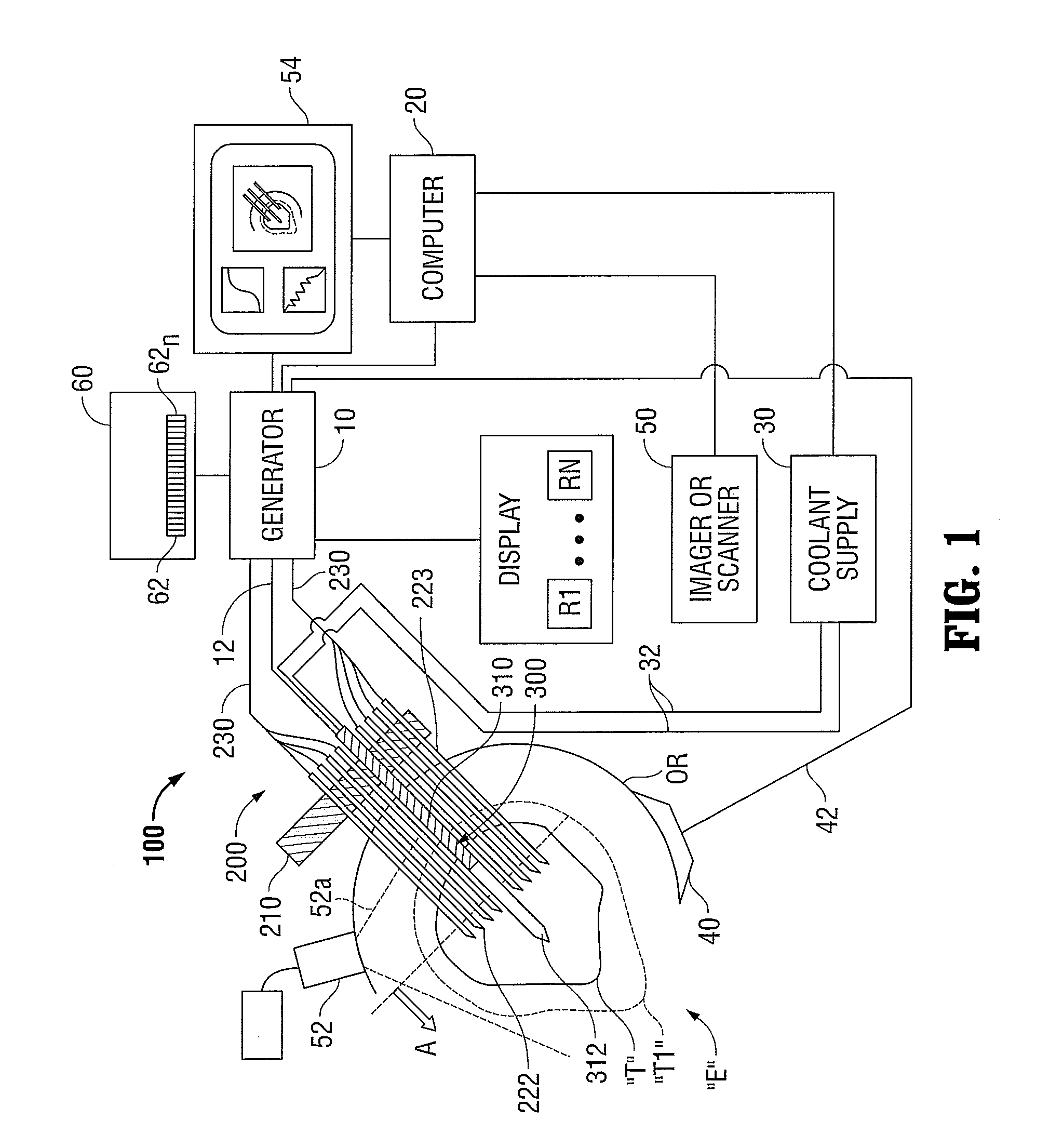 Temperature Based Ablation Completeness Algorithm