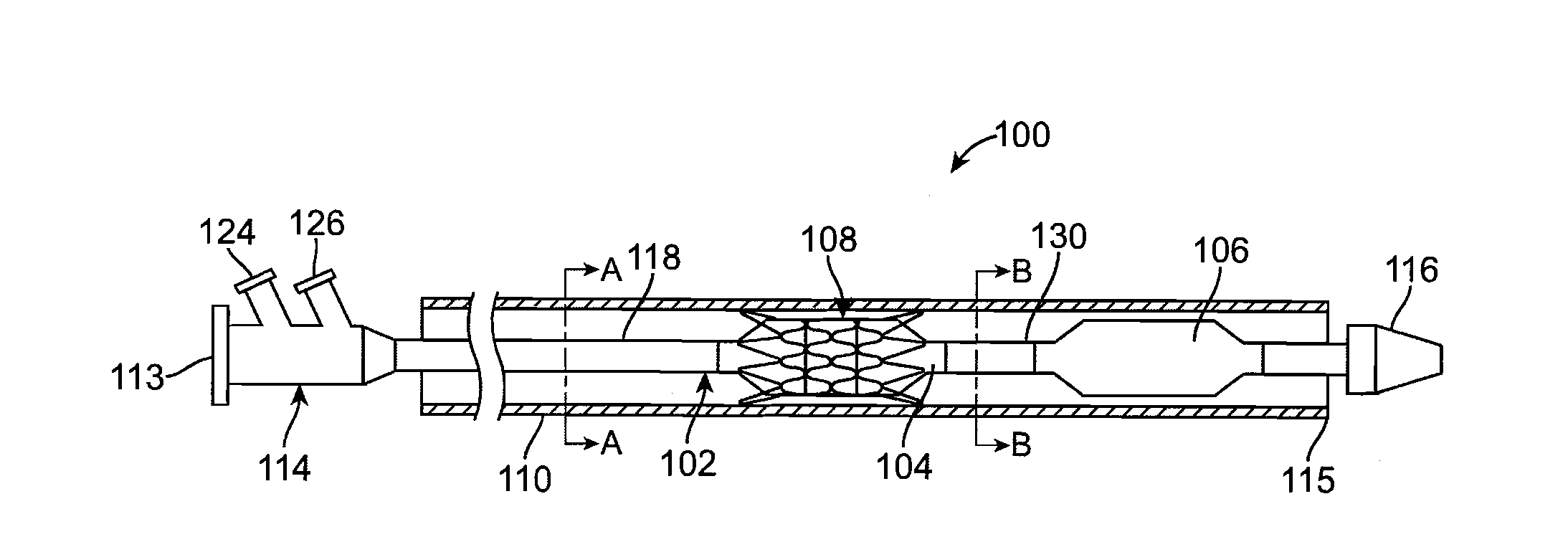 Prosthetic Valve Delivery System