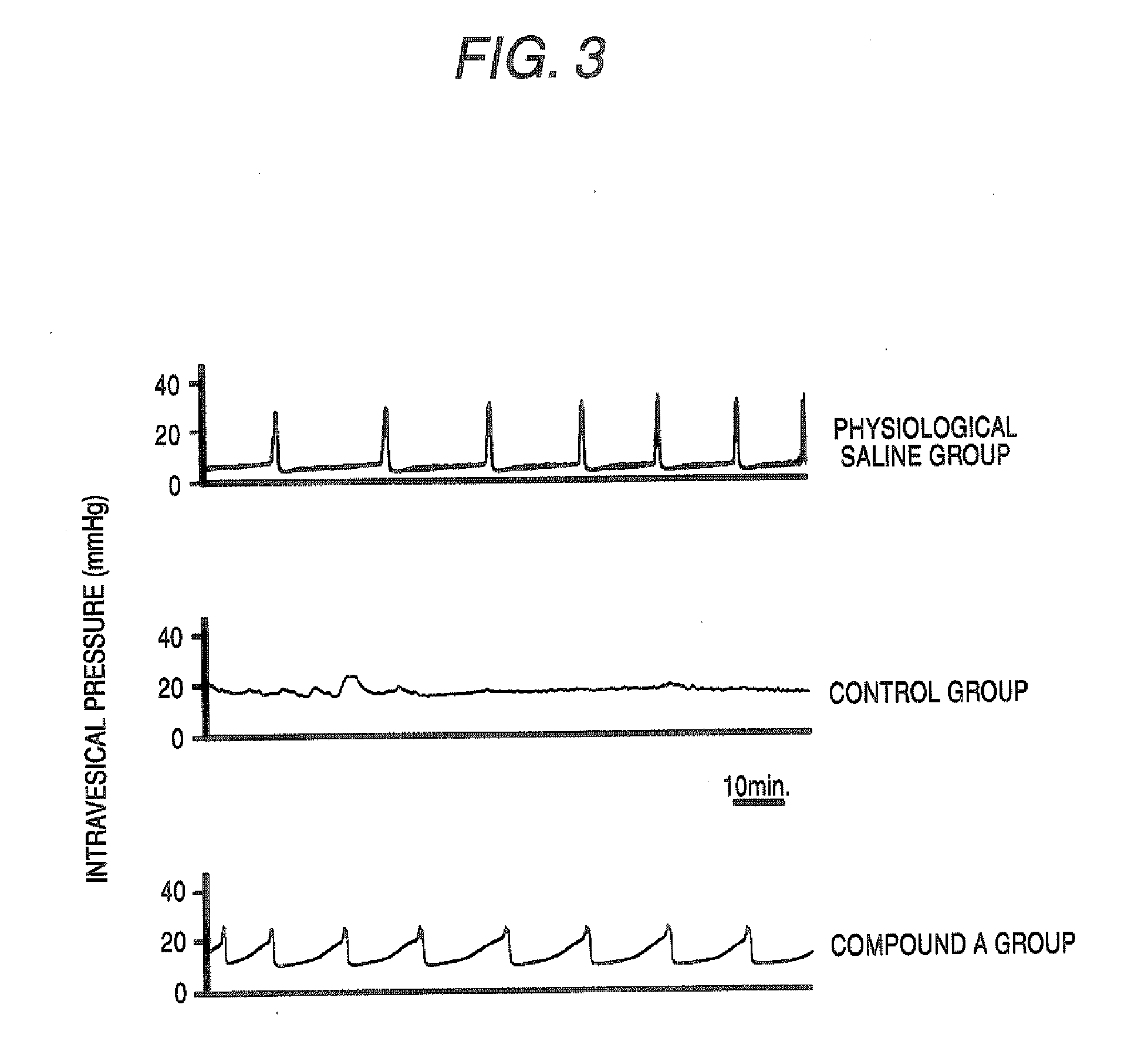 Agent for treating chronic pelvic pain syndrome