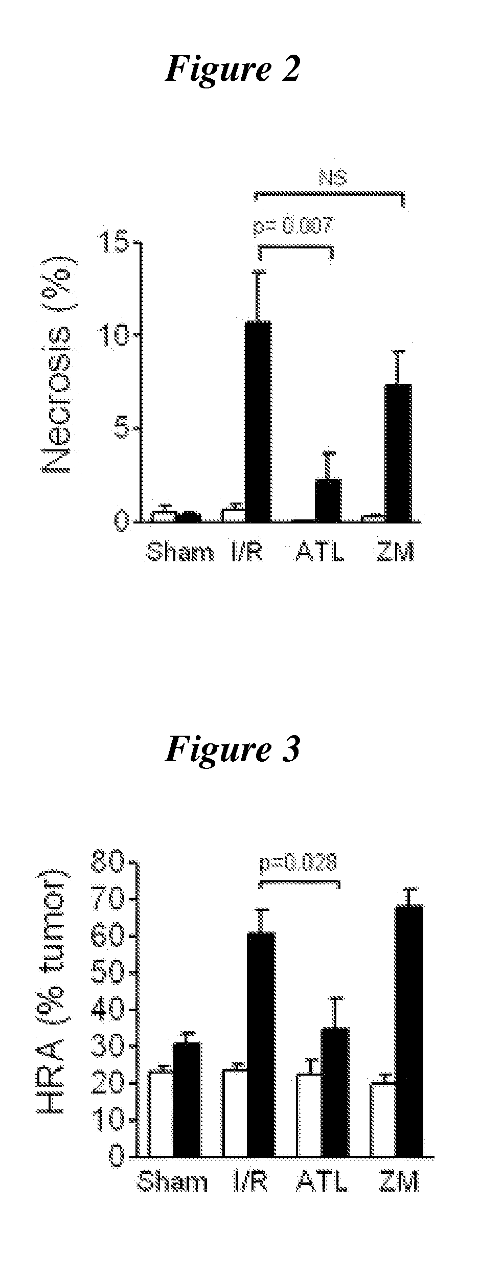 Agonists of a2a adenosine receptors for treating recurrent tumor growth