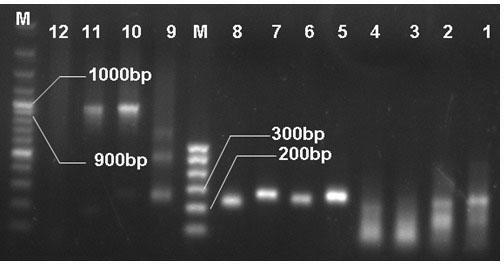 Transformation of acidic beta-mannase gene and construction of engineering bacteria of acidic beta-mannase gene