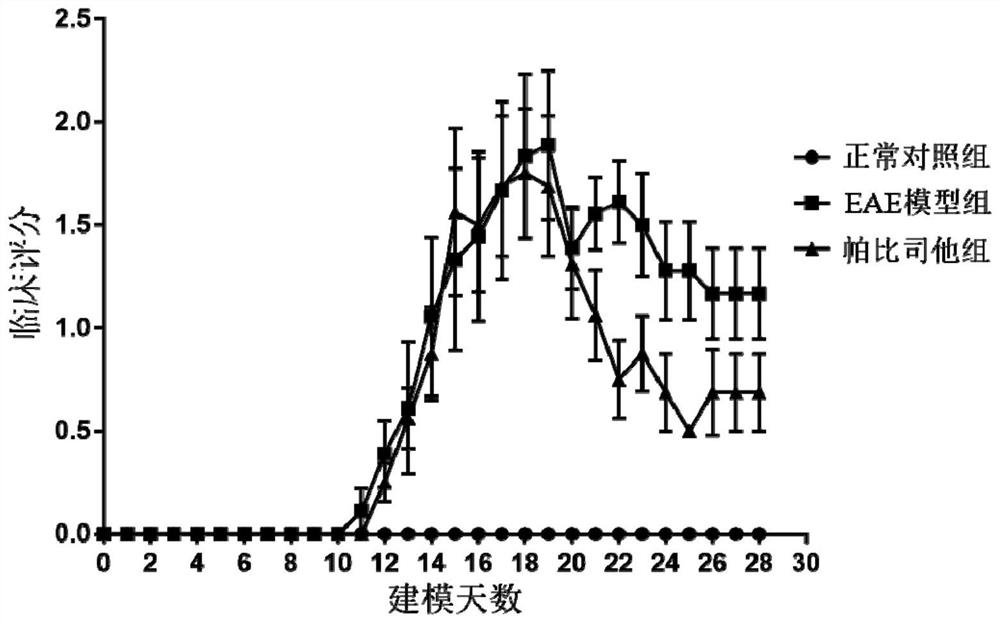 Application of panobinostat in preparation of medicine for preventing, relieving and/or treating multiple sclerosis