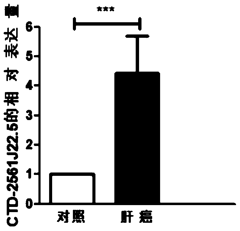 Reagent for detecting and targeting lncRNA biomarker and application of reagent to hepatocellular carcinoma