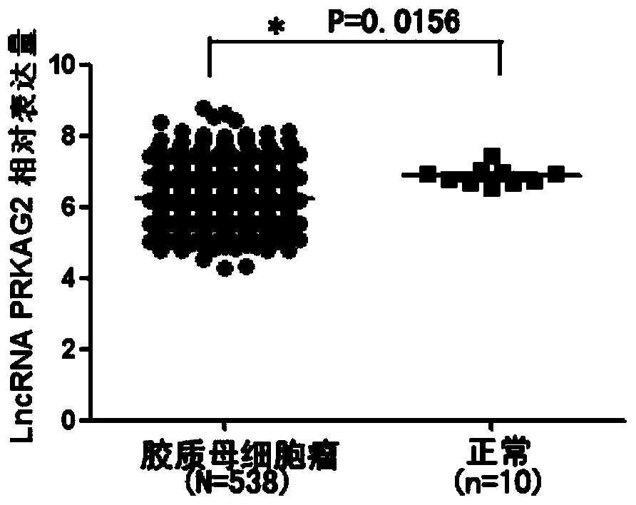 Application method of serum Exosomes-derived long non-coding RNA PRKAG2-AS1