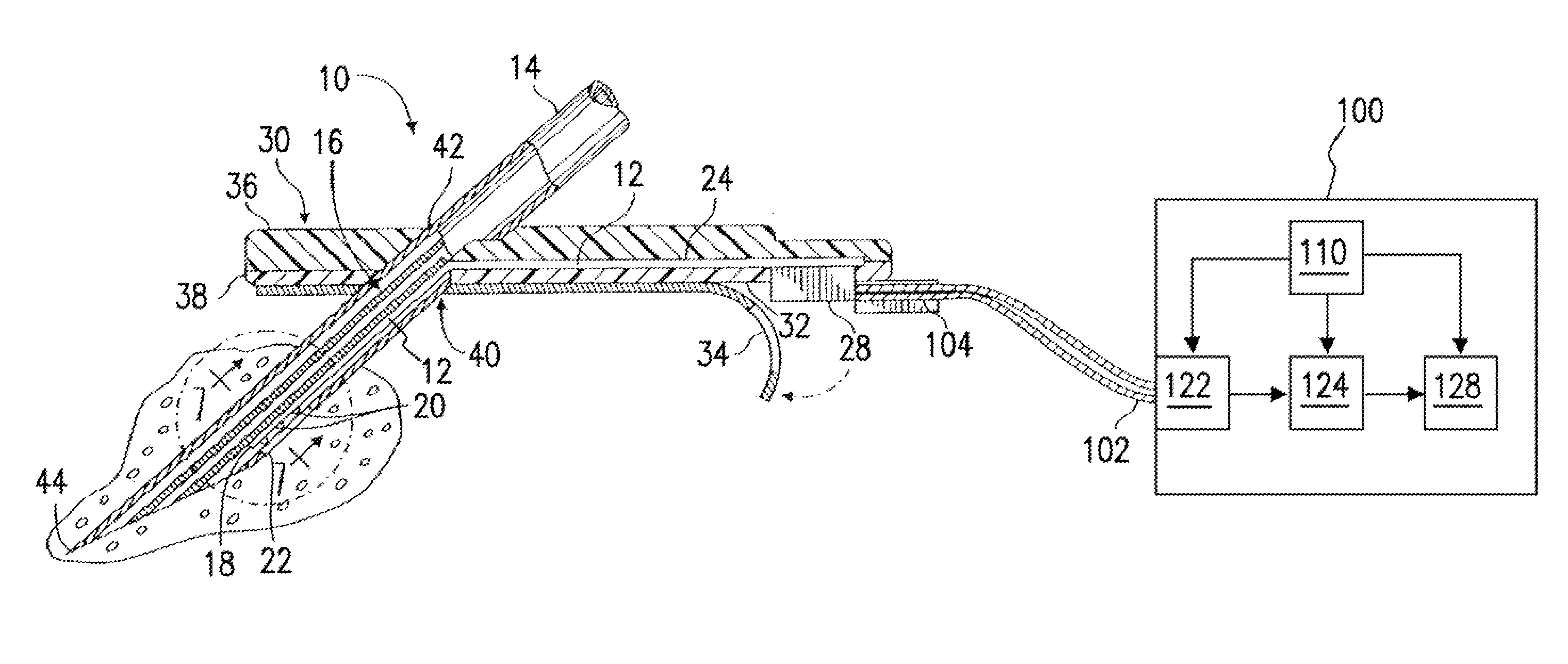 Use of electrochemical impedance spectroscopy (EIS) in intelligent diagnostics