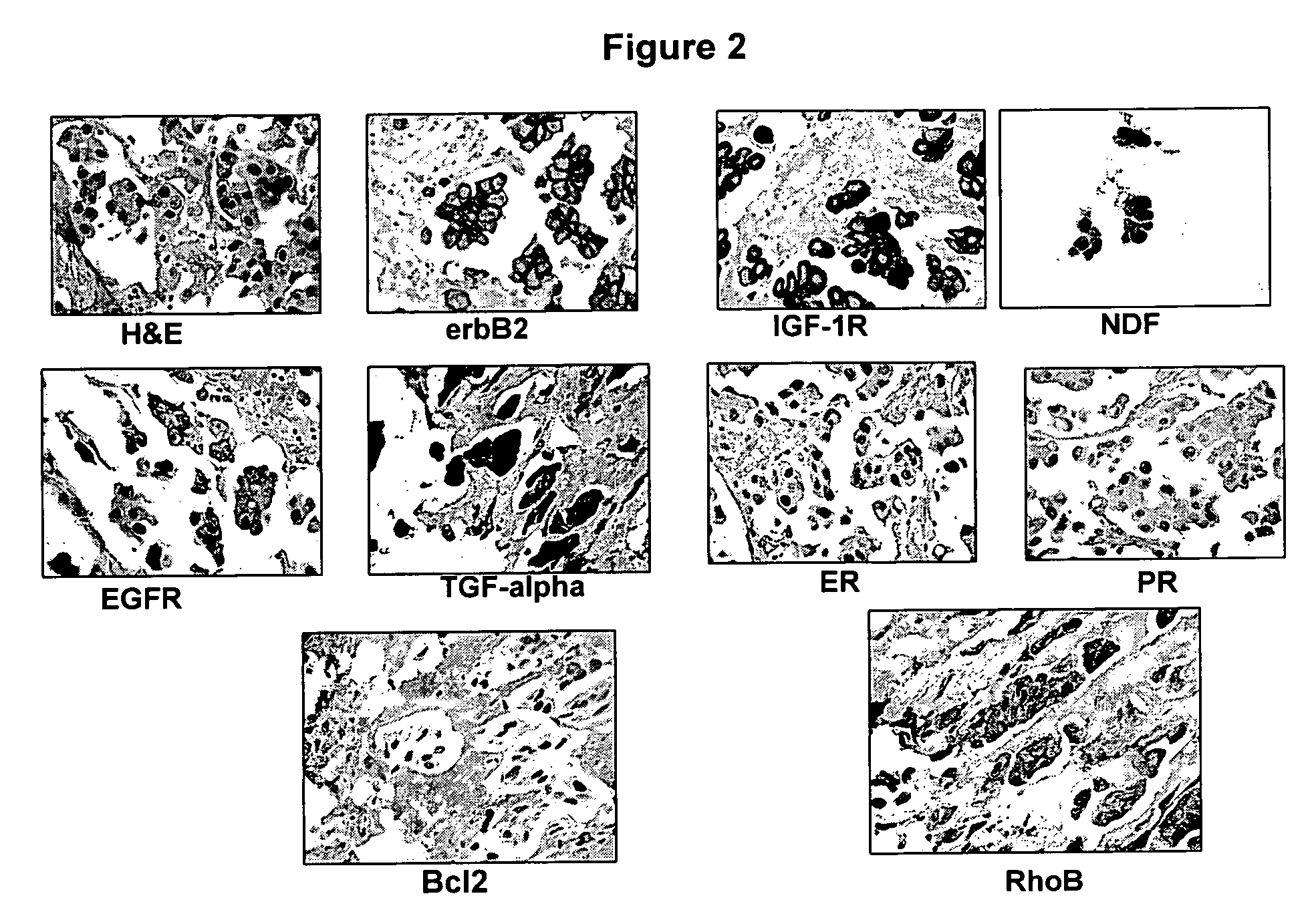 Targeted therapy marker panels