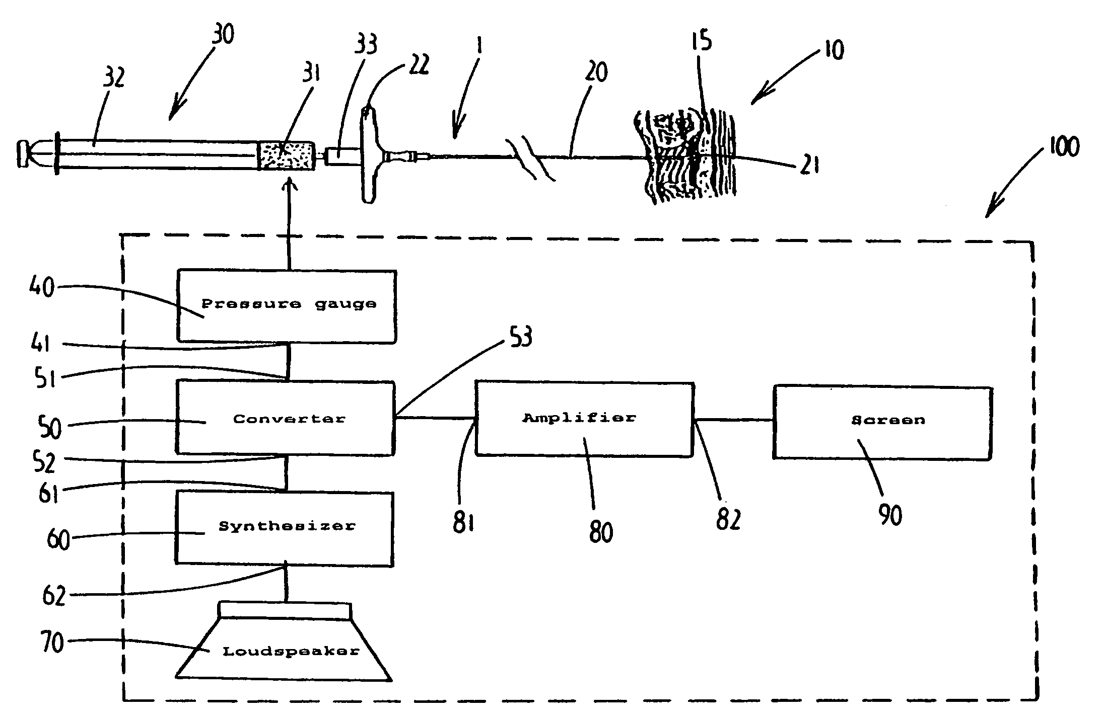 Device and method for locating anatomical cavity in a body