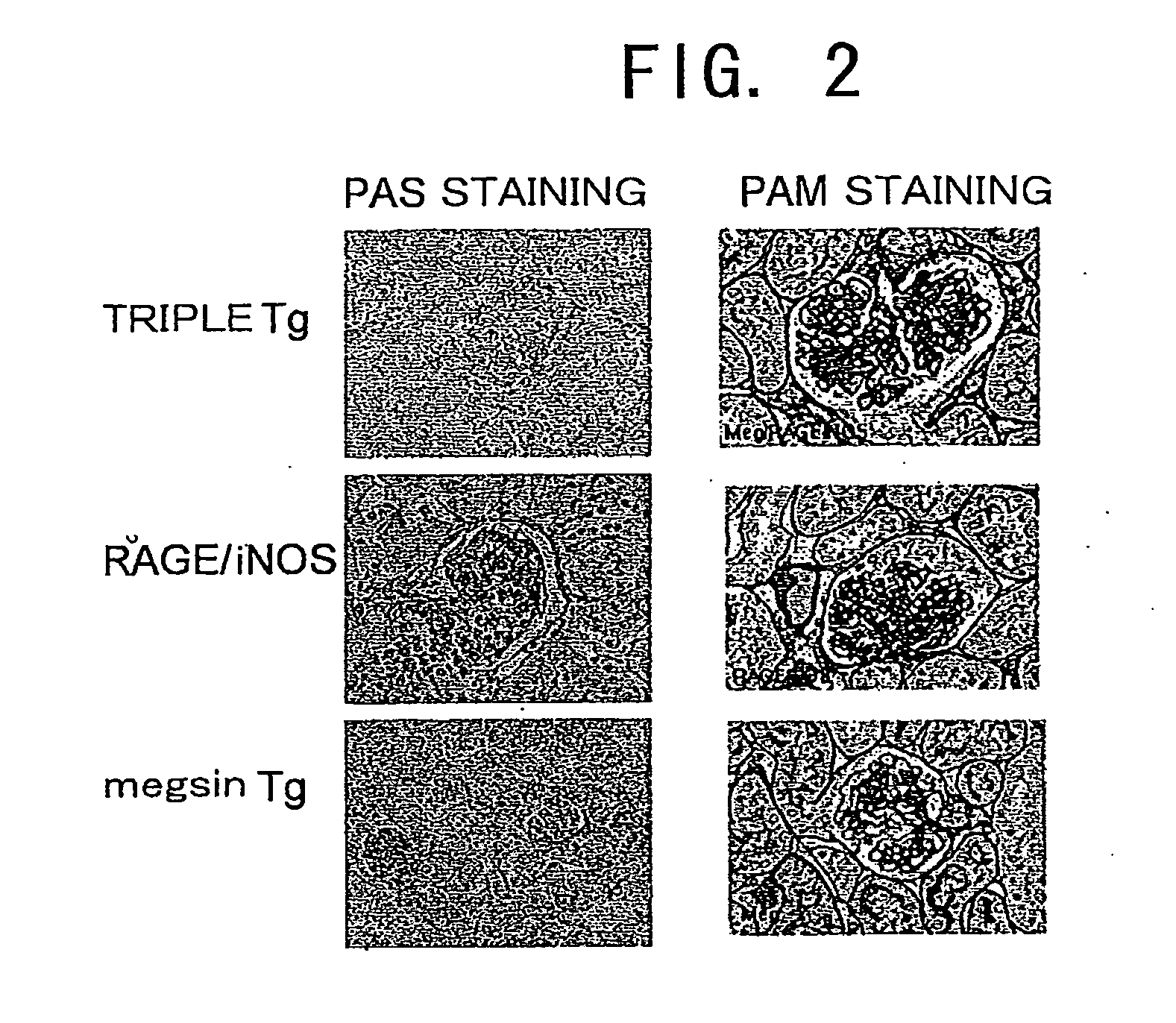 Megsin/Rage/Inos-Overexpressing Renal Disease Model Animals and Methods for Evaluating Compounds Using the Model Animals