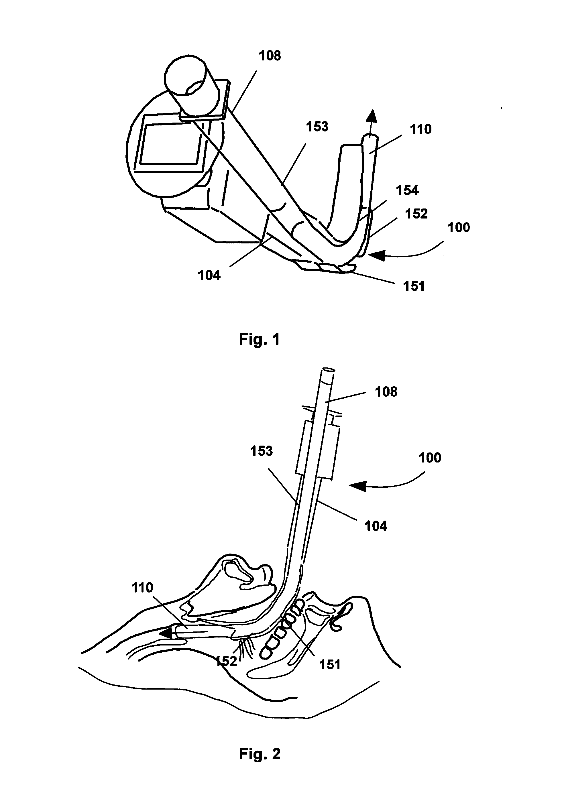 Device supporting tracheal tube