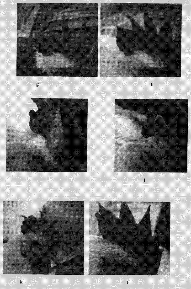 Medicinal composition for treating nevus flammeus and preparation method thereof