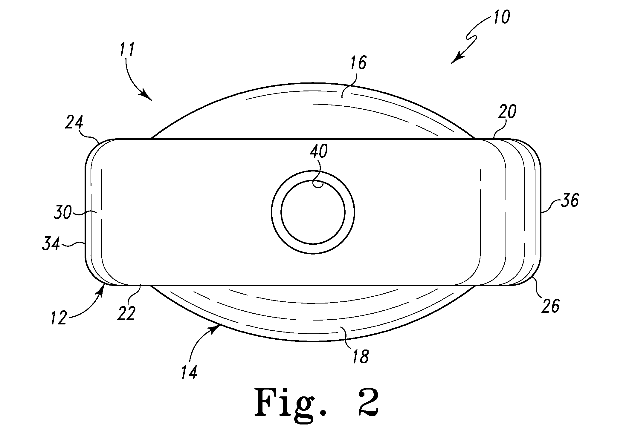 Spinal Interbody Device