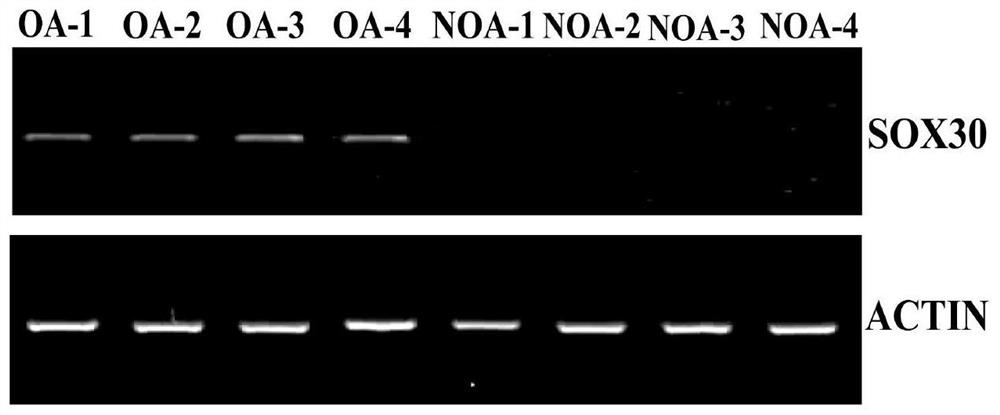 A diagnostic kit for non-obstructive azoospermia