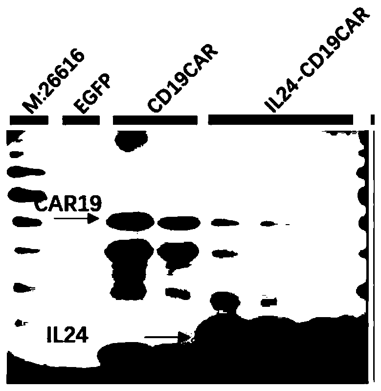 Recombinant CAR19-IL24 gene, lentiviral vector, CAR19-IL24-T cell and application of recombinant CAR19-IL24 gene, lentiviral vector and CAR19-IL24-T cell