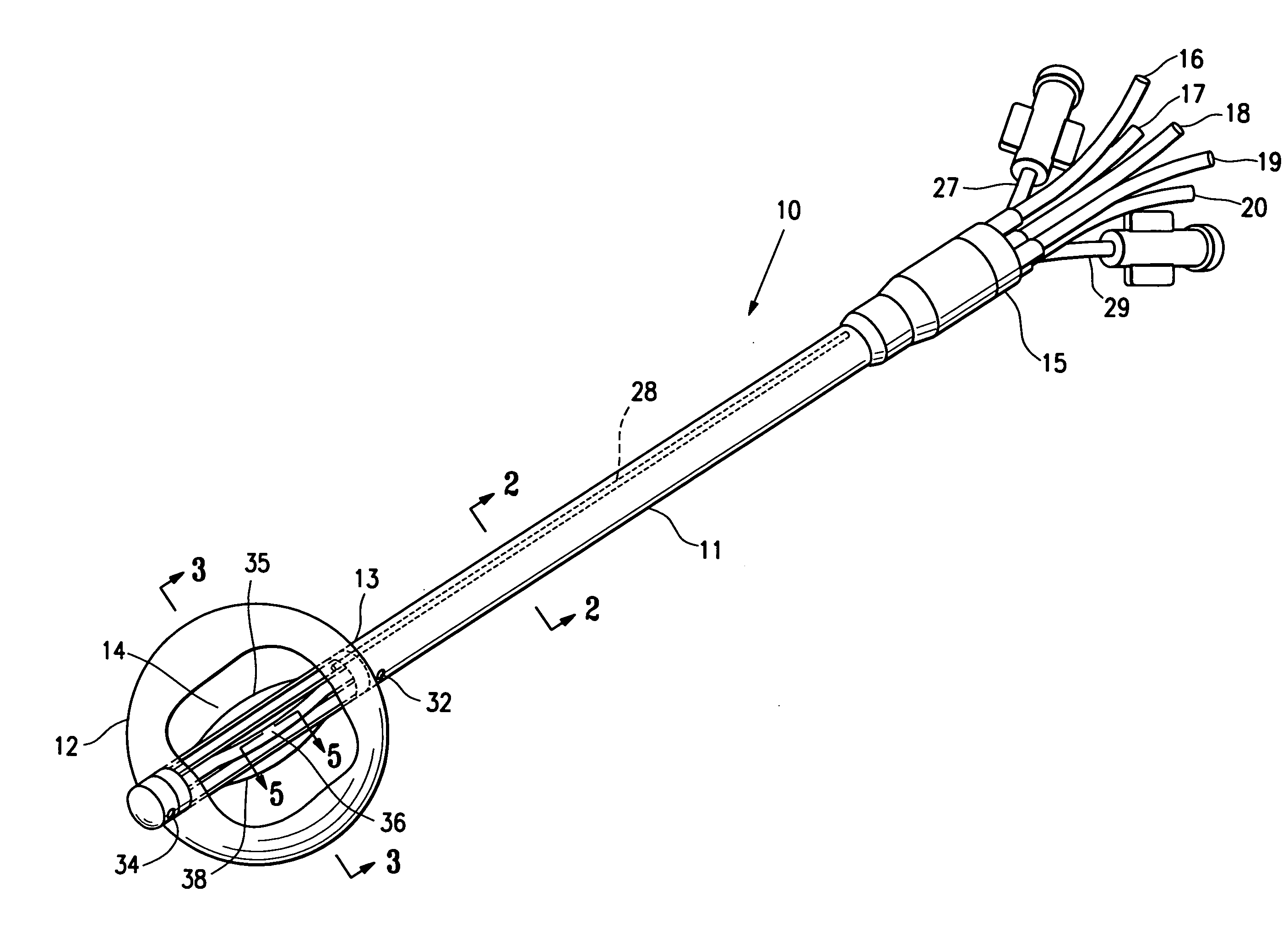 Soft body catheter with low friction lumen