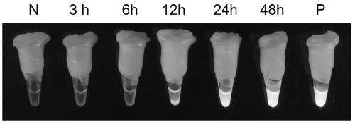 Bipolaris sorokiniana loop mediated isothermal amplification (LAMP) detection primer group and application thereof