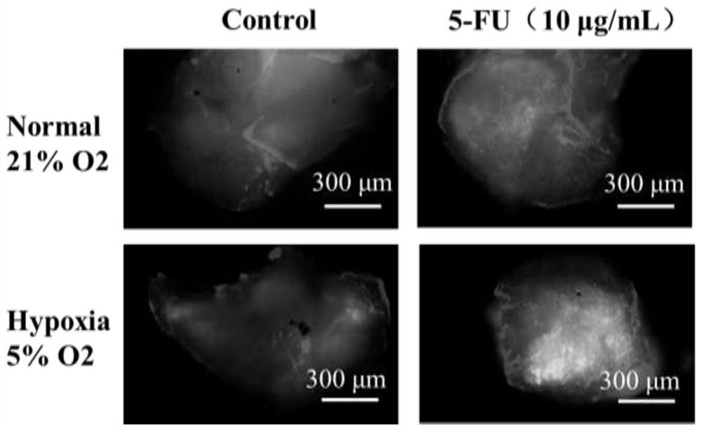 Tumor precise and personalized drug treatment method and application