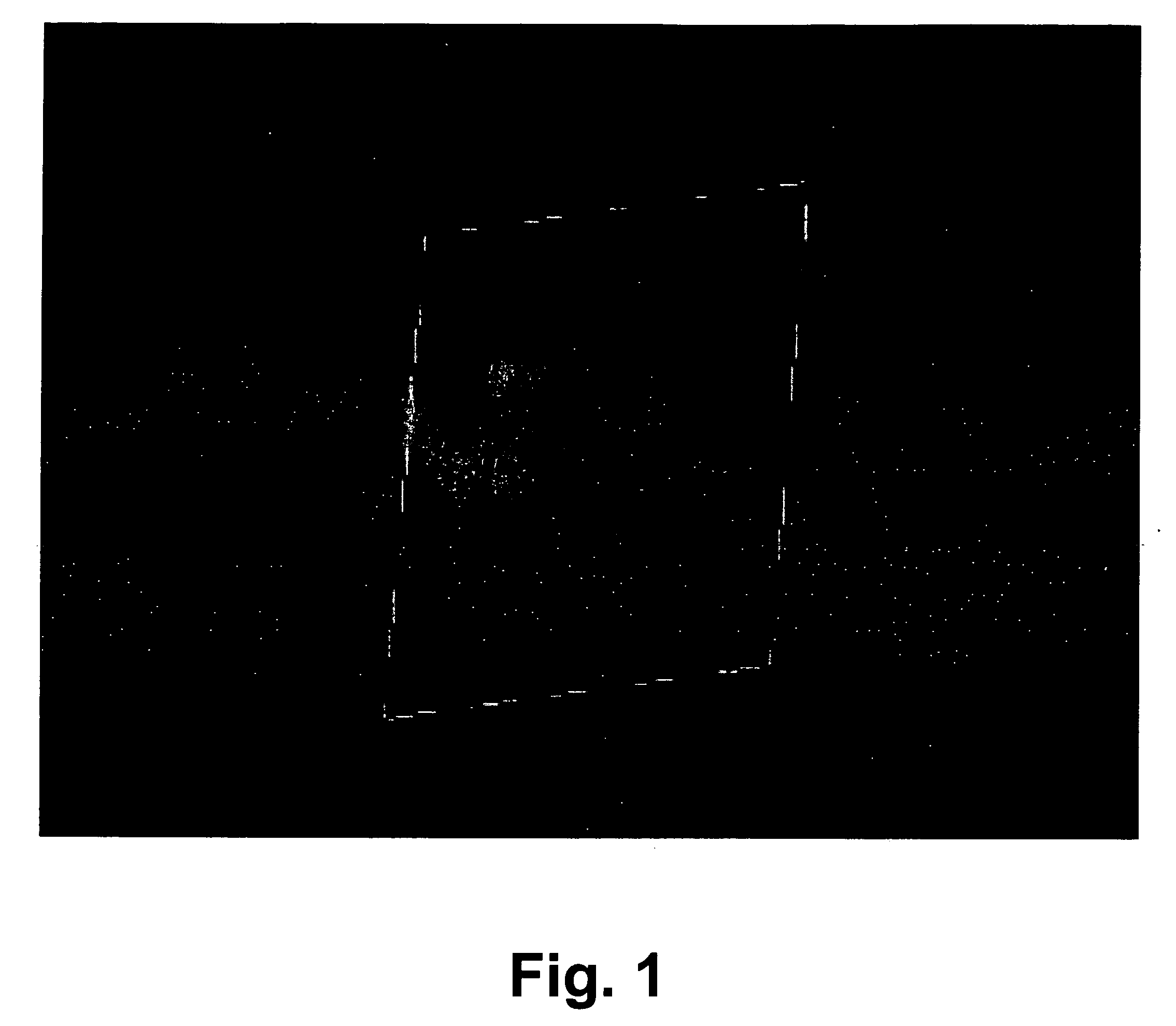 Method for aiding stent-assisted coiling of intracranial aneurysms by virtual parent artery reconstruction