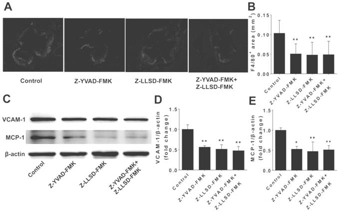 A gsdmd inhibitor