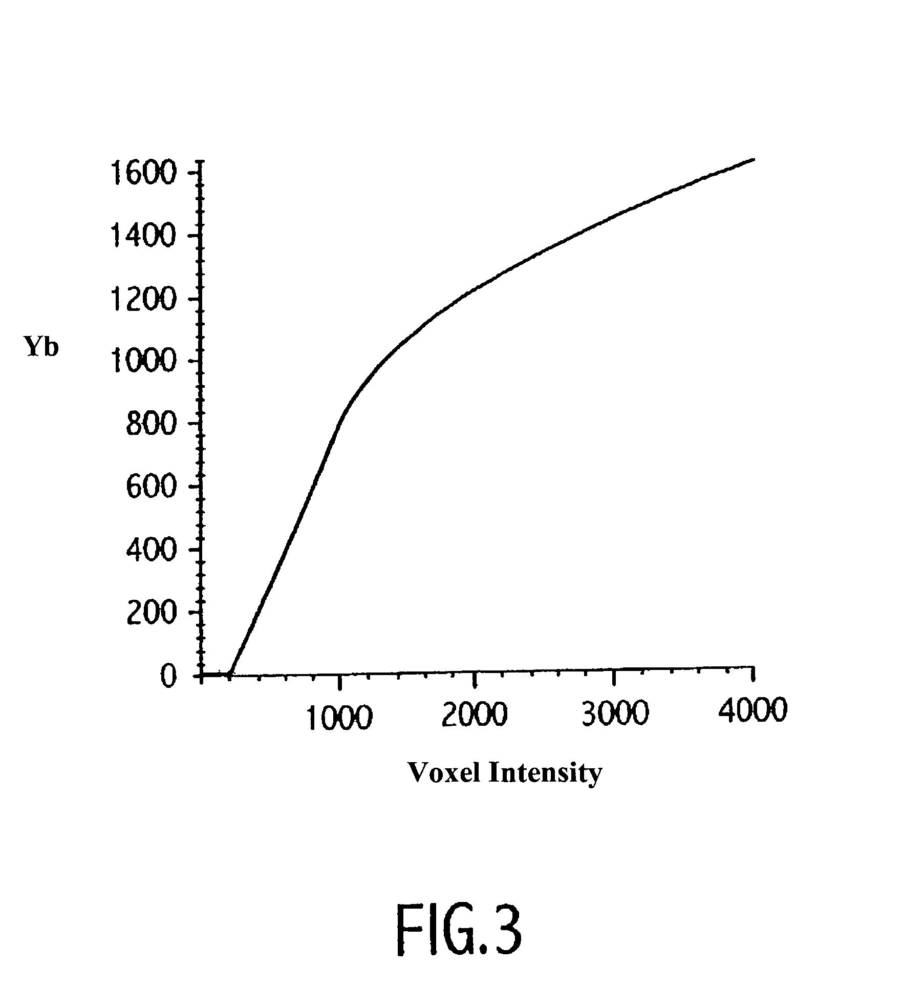 Method and system for processing vascular radiographic images which have been reconstructed by three-dimensional modelling