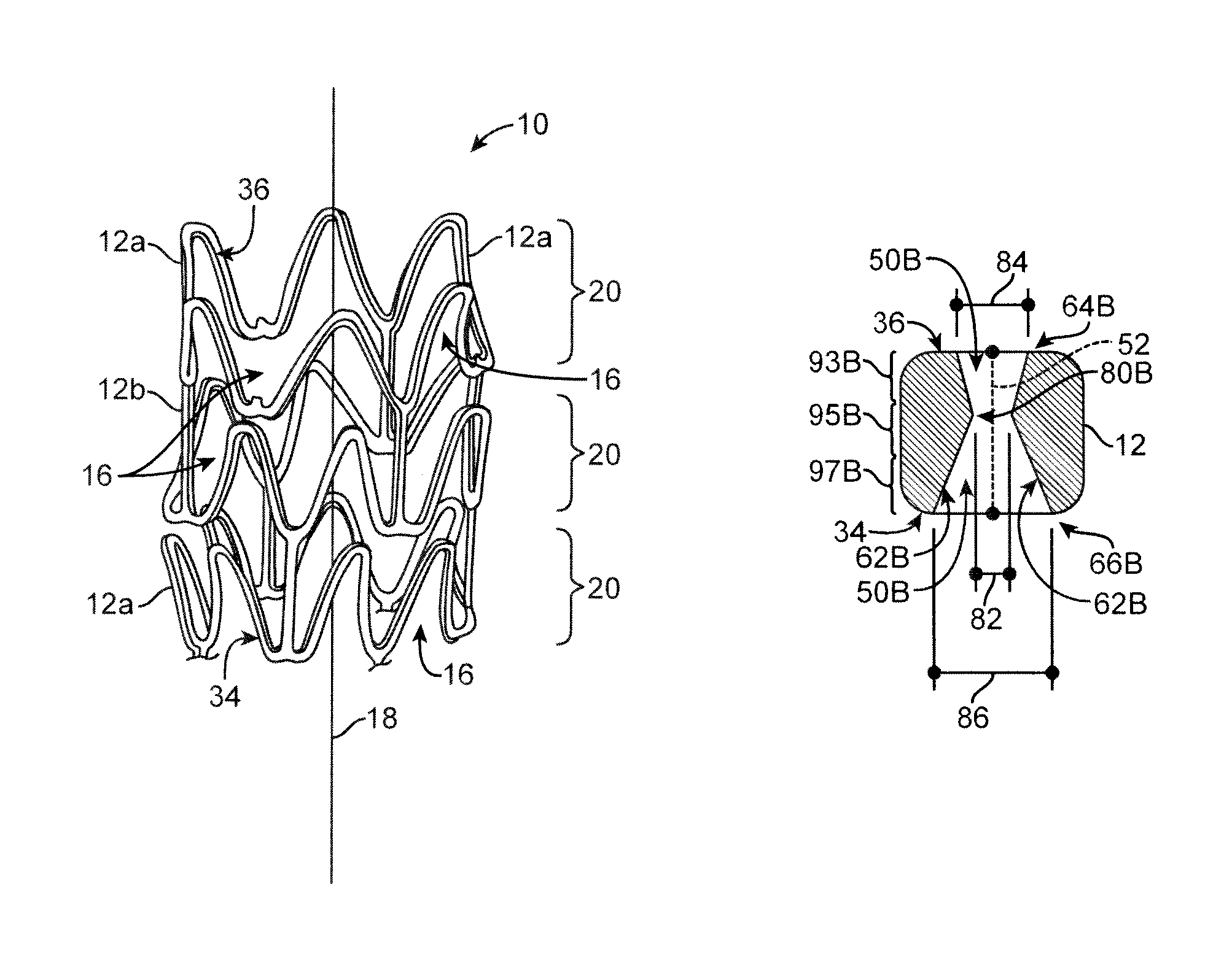 Implantable prosthesis with depot retention feature