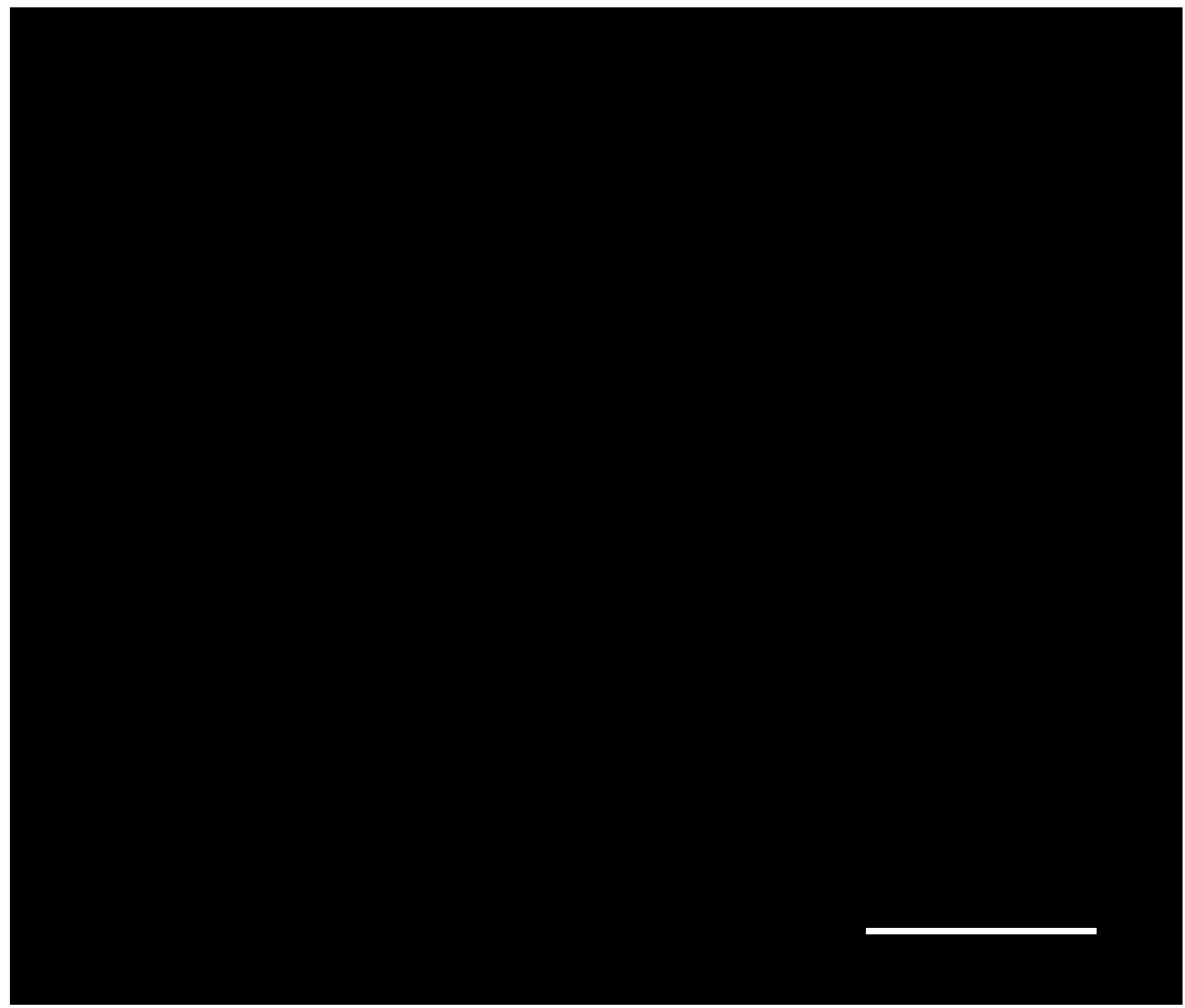 Composite active bone cement containing sustained release drug-loading nanoparticles and preparation method of bone cement