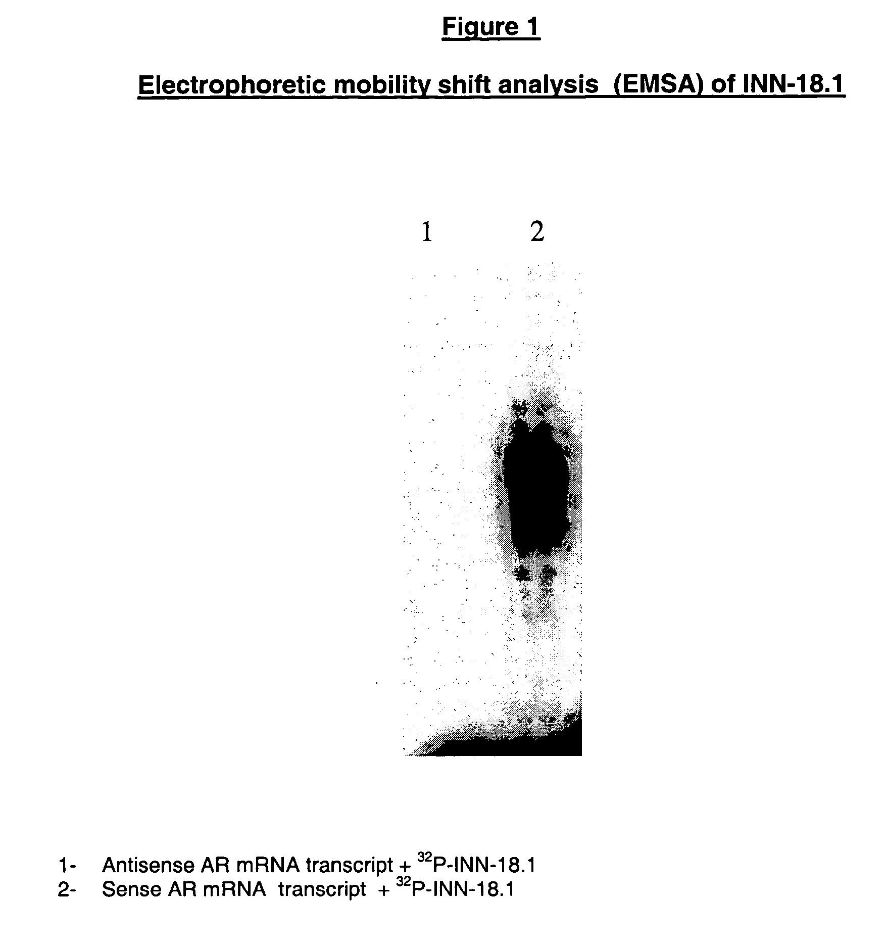 Antiandrogen oligonucleotides usable for the treatment of dermatological androgen-related disorders relating to androgen metabolism, their pharmaceutical compositions, their uses and treatment method