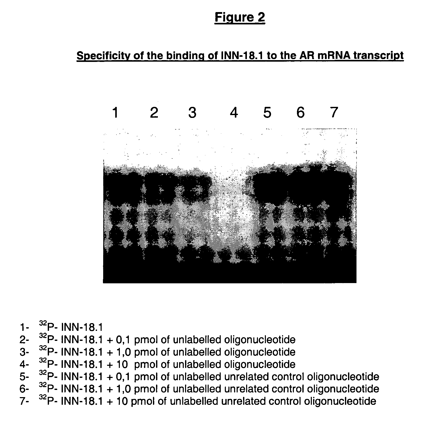 Antiandrogen oligonucleotides usable for the treatment of dermatological androgen-related disorders relating to androgen metabolism, their pharmaceutical compositions, their uses and treatment method