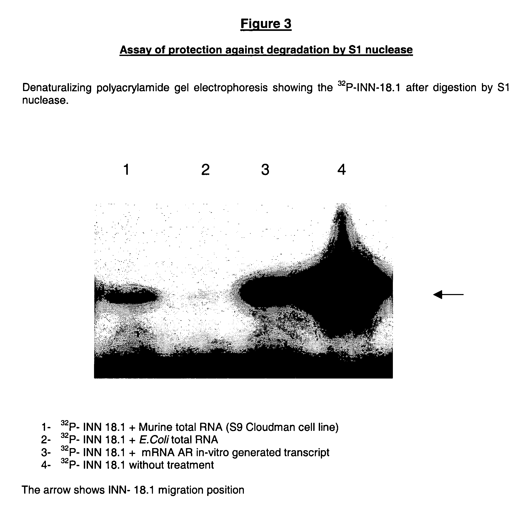 Antiandrogen oligonucleotides usable for the treatment of dermatological androgen-related disorders relating to androgen metabolism, their pharmaceutical compositions, their uses and treatment method