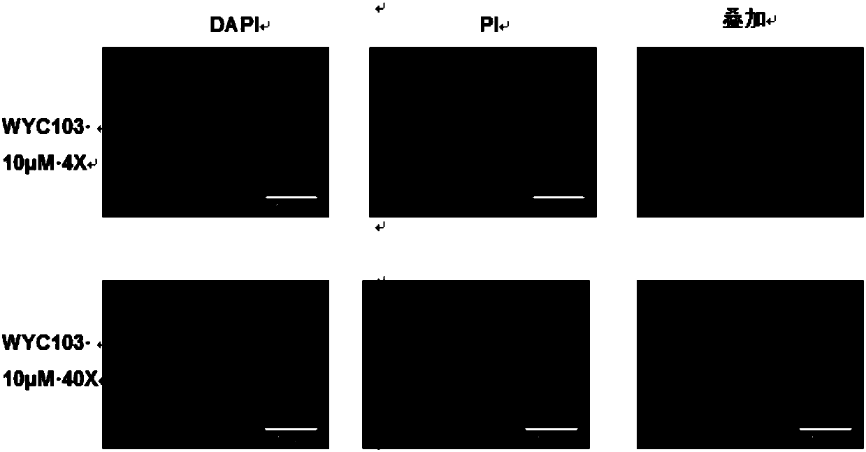 Retinoic acid compound, and preparation method, intermediate and application thereof