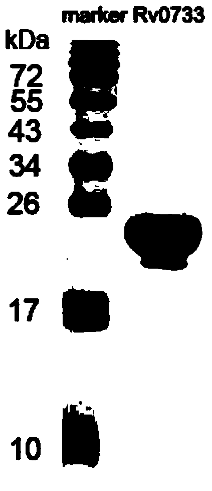 Reagent for detecting specific immune response of mycobacterium tuberculosis and use thereof