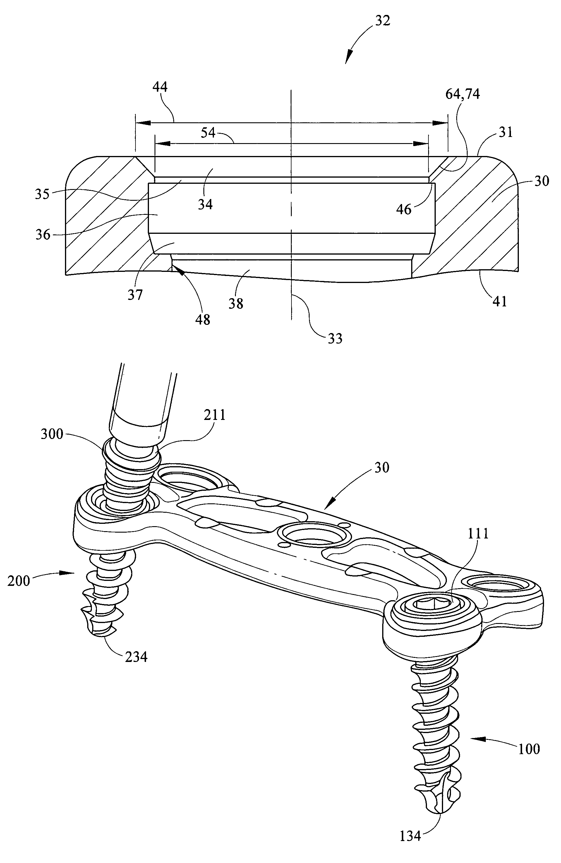 Fixed and variable locking fixation assembly