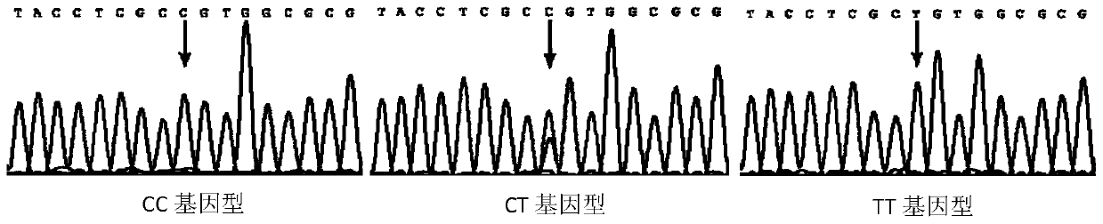 SNP locus related to rapid growth of takifugu obscurus and application thereof