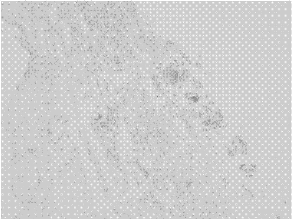 Preparation method of natural soft tissue decellularization matrix