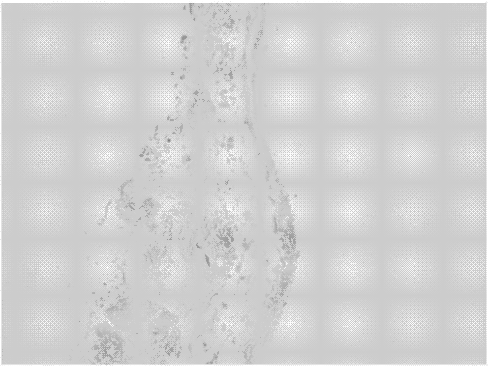 Preparation method of natural soft tissue decellularization matrix