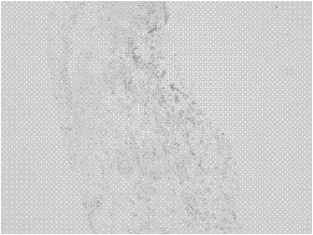 Preparation method of natural soft tissue decellularization matrix