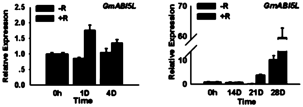 Method for cultivating highly noduled transgenic plants based on RNA interference technology