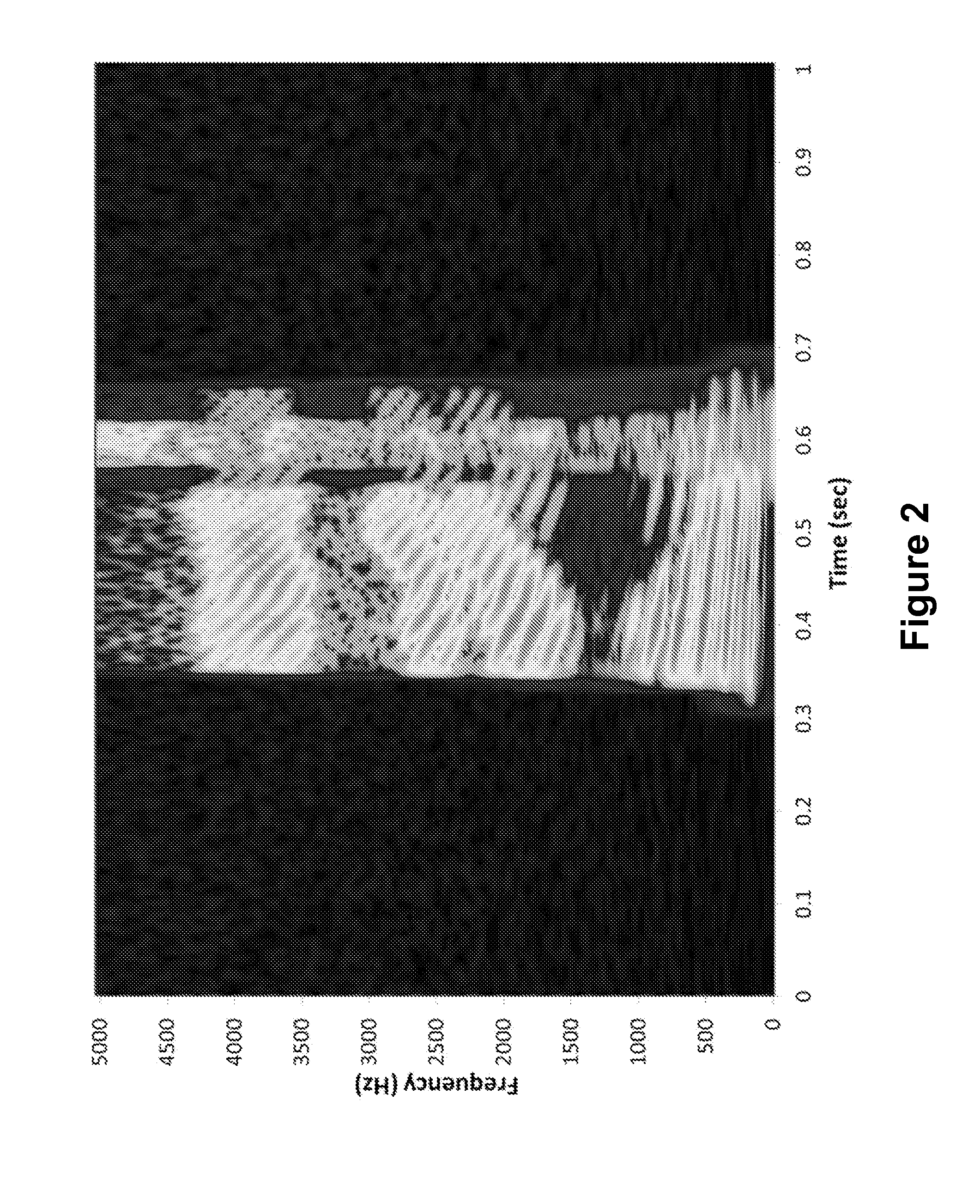 Method and Apparatus for Evaluating Dynamic Middle Ear Muscle Activity