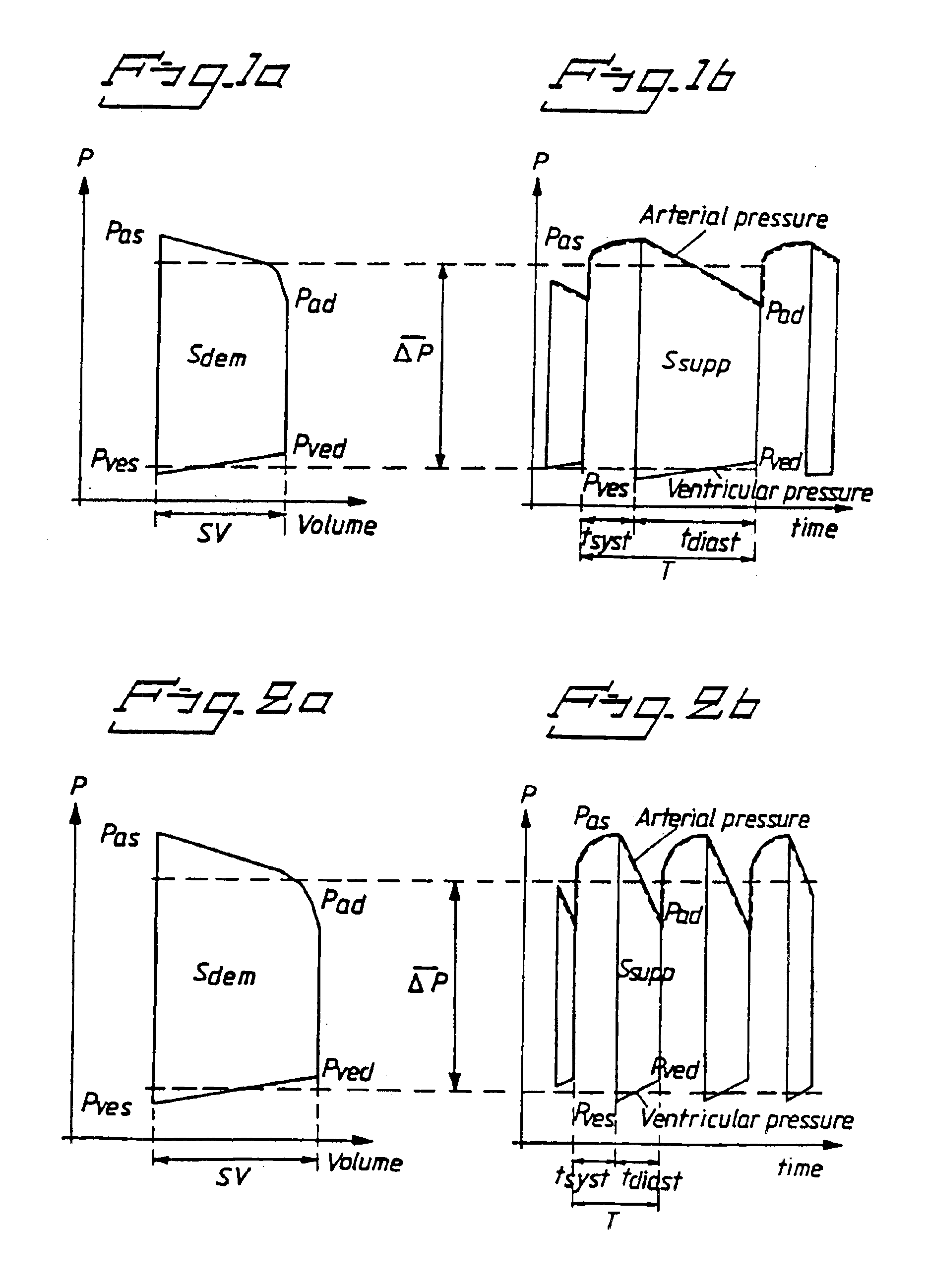 Rate adaptive pacemaker