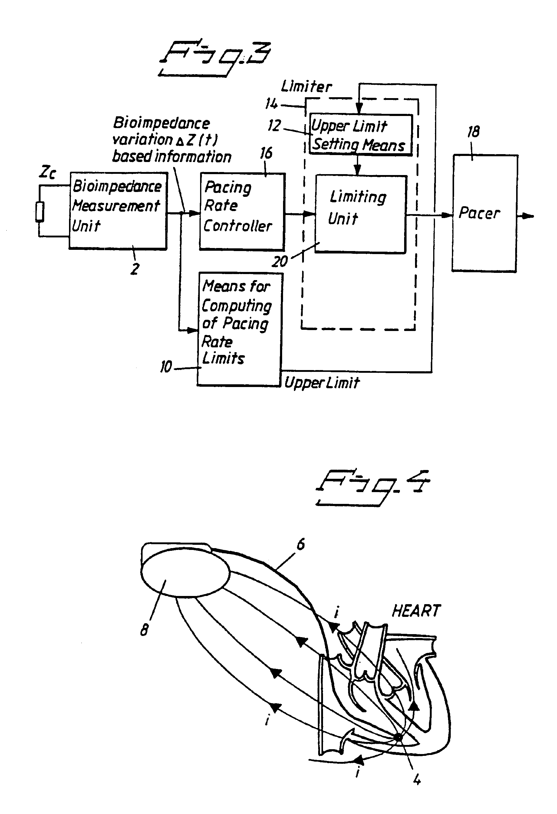 Rate adaptive pacemaker