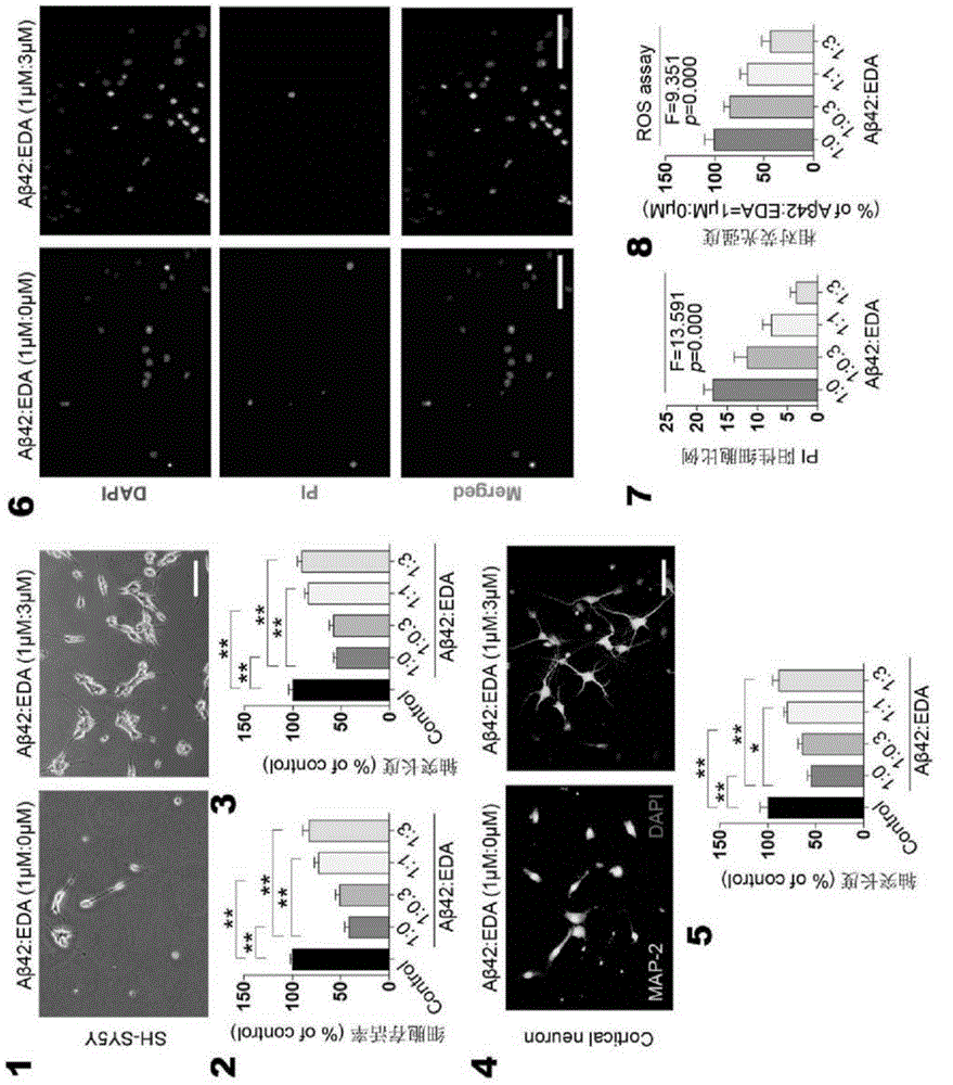 Use of edaravone in preparation of drug for preventing and treating cerebral amyloid angiopathy (CAA)