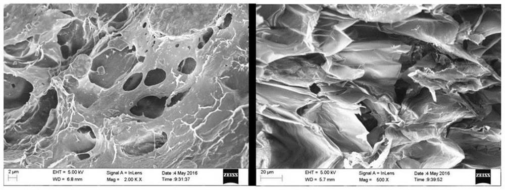 A temperature-sensitive injectable lacrimal plug and its preparation method